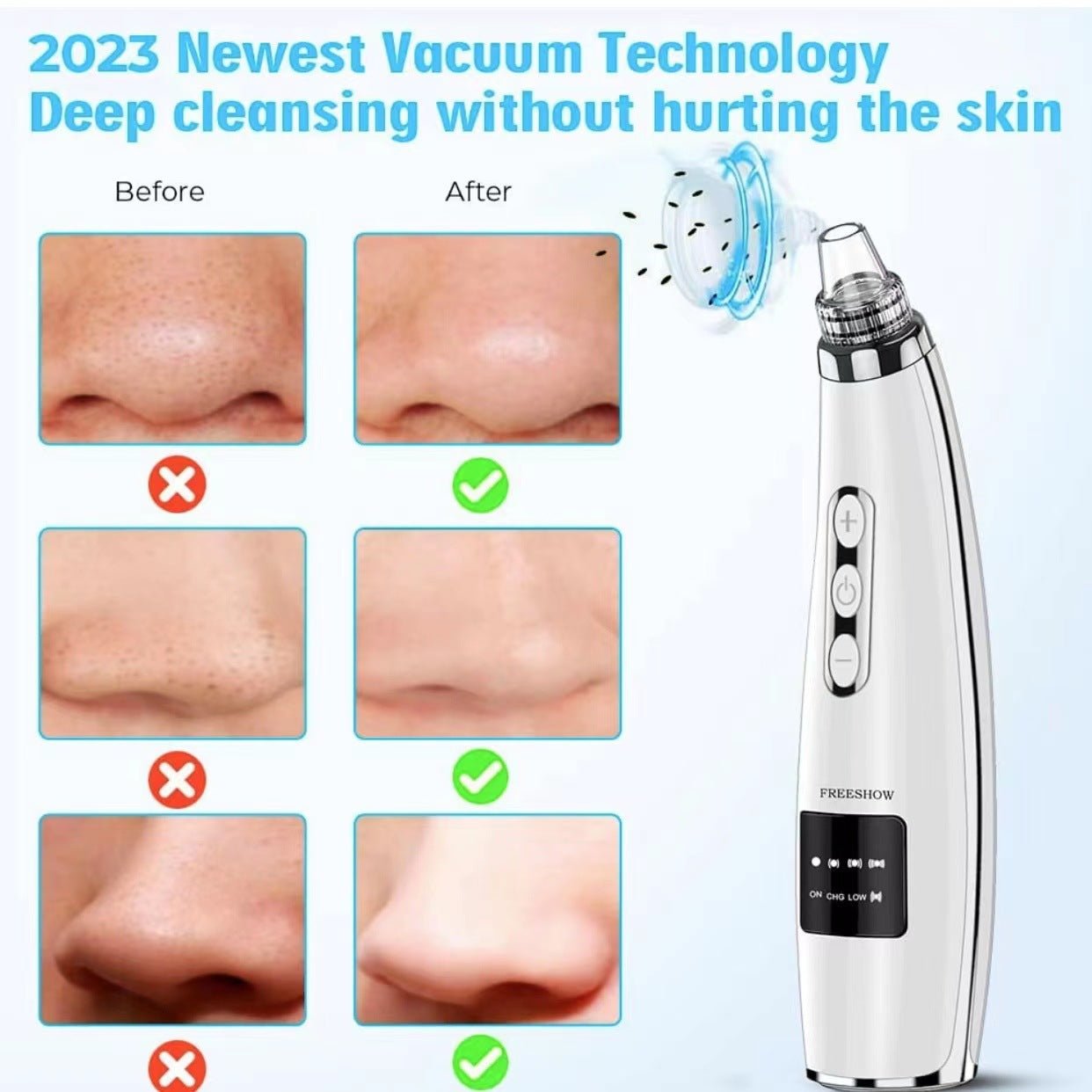 Portable Home Pore Cleaner Blackhead Device